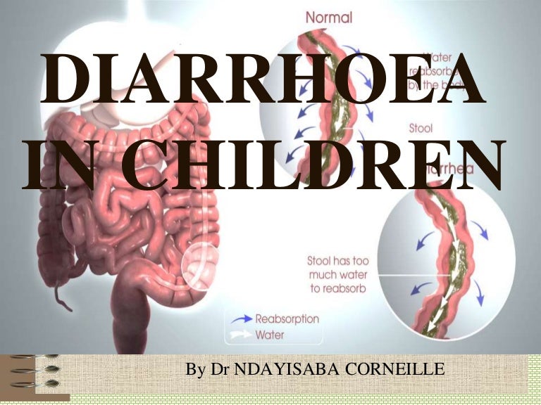 Diarrhoea in children