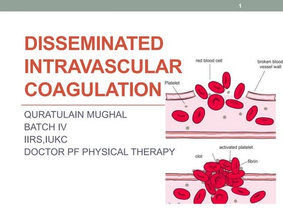 Disseminated intravascular coagulation | PPT
