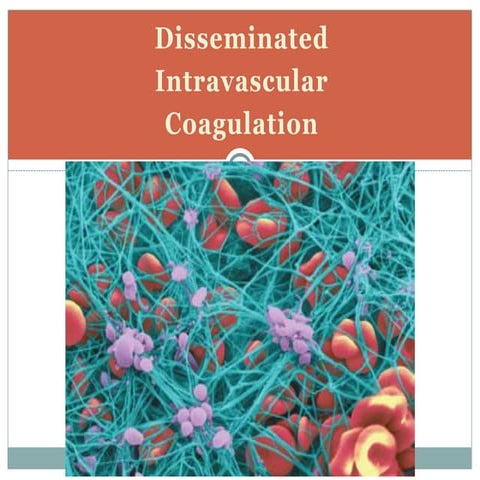 Disseminated Intravascular Coagulation | PPT
