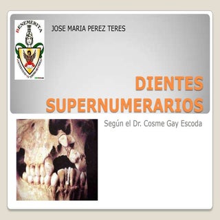 Dientes supernumerarios