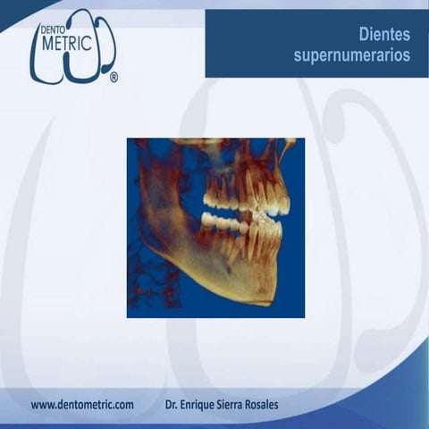 Dientes supernumerarios