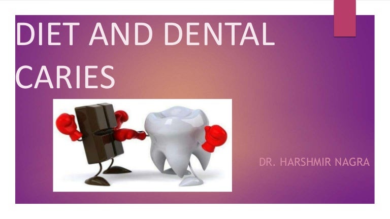 Diet and dental caries