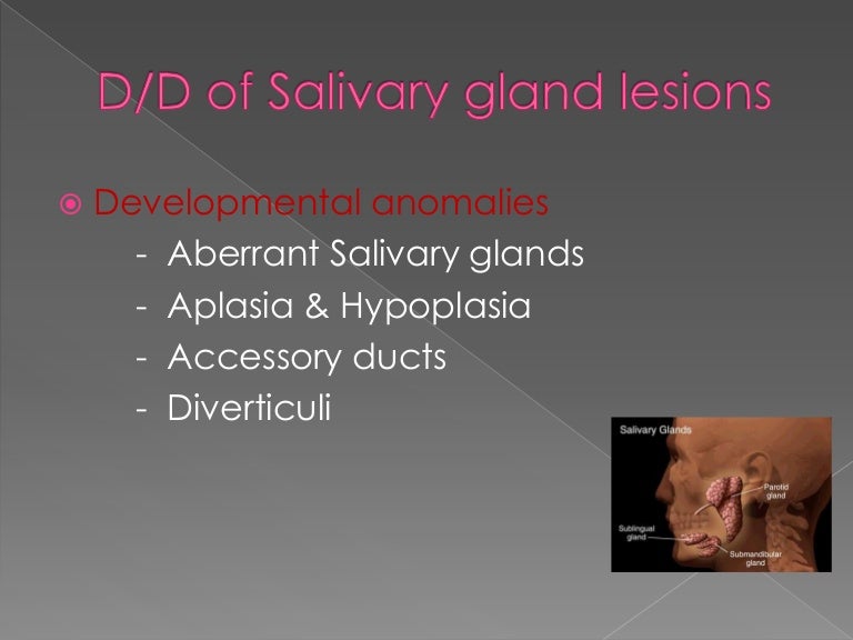 Differential Diagnosis of Salivary Gland Lesions
