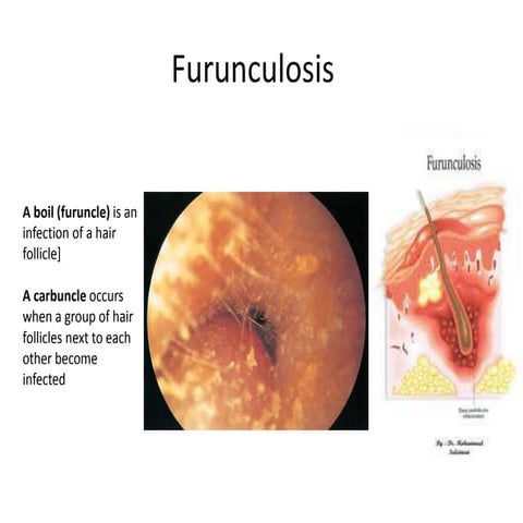 Different ear condition | PDF