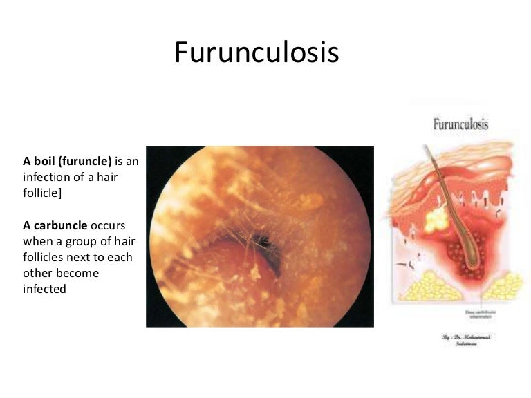 Different ear conditions ear diagram powerpoint 