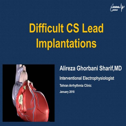 Difficult Coronary Sinus Lead Implantation