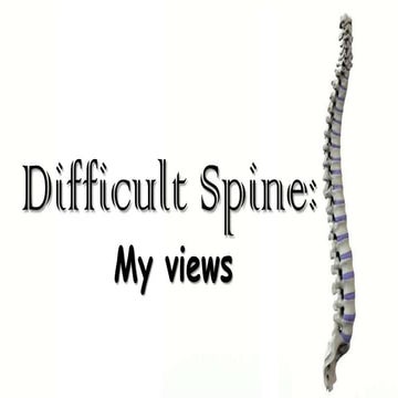 Difficult spine:my views!