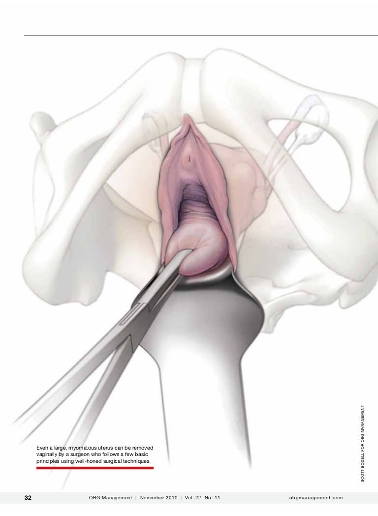 olympics-japan-orgasm-soon-after-a-hysterectomy-romanian