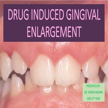 Drug induced gingival enlargement - DIGO