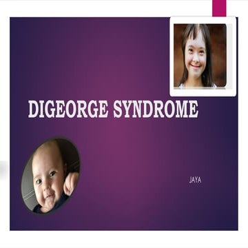 DiGeorge Syndrome | PPTX