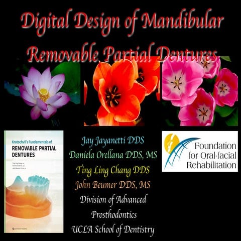 Digital Design of Mandibular Removable Partial Dentures