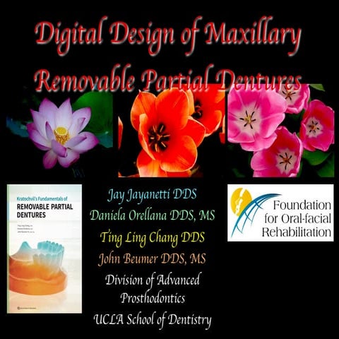 Digital design of maxillary of rpd's