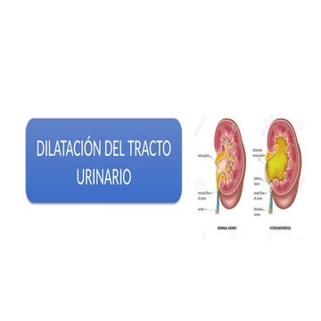 dilatacion-del-tracto-urinario-final-pptx
