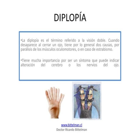 Diplopia | PPTX