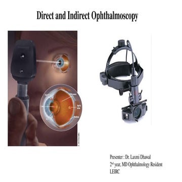 Direct and Indirect Ophthalmoscopy..pptx