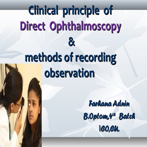 Direct opthalmoscopy~@Farhana.Islam