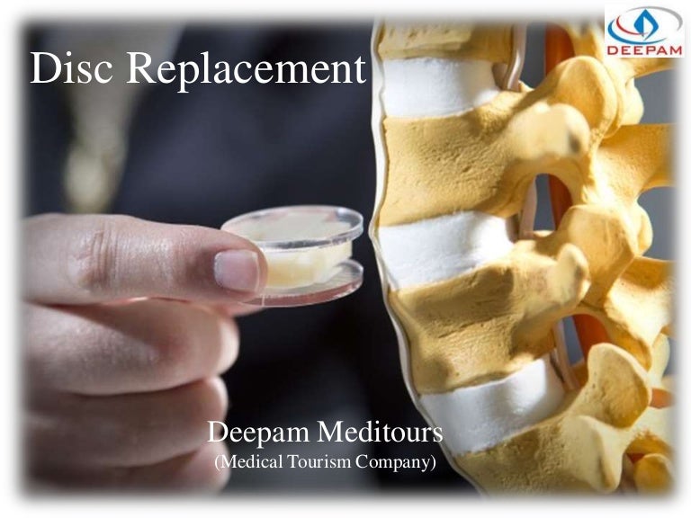 Disc Replacement surgery