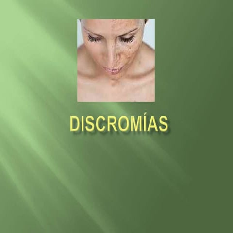 Discromías | PPTX