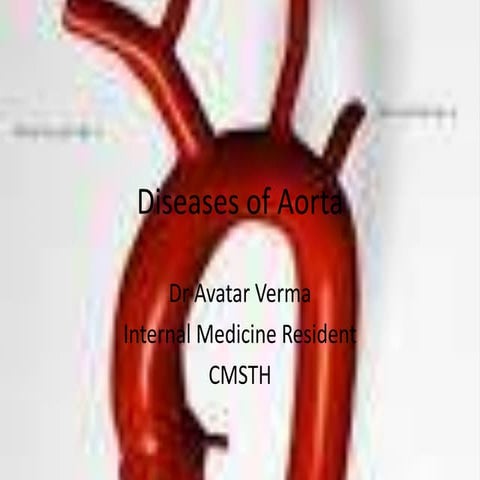 Diseases of aorta