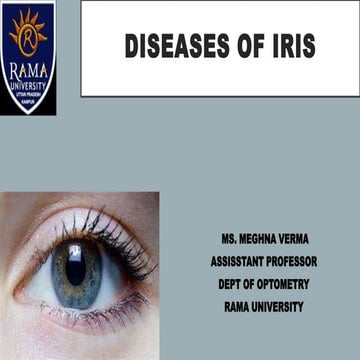 DISEASES OF IRIS.pptx