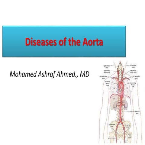 Diseases of the aorta