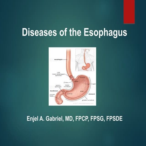 Diseases of the Esophagus by Gabriel MD.