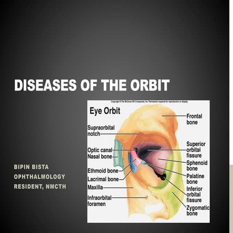 Diseases of the orbit