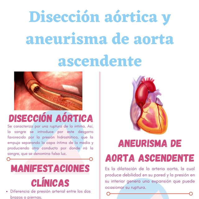 Disección aórtica y aneurisma de aorta ascendente | PDF