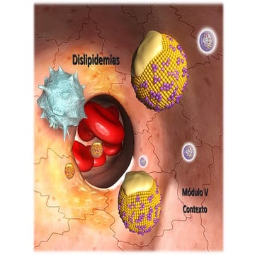 Dislipidemias mod 5 prevención primaria, estimación del riesgo cardiovascular...