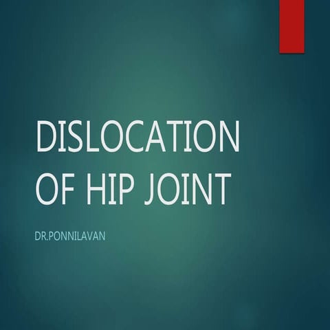 Dislocation of hip