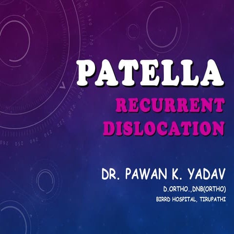 Recurrent Dislocation of patella -PAWAN