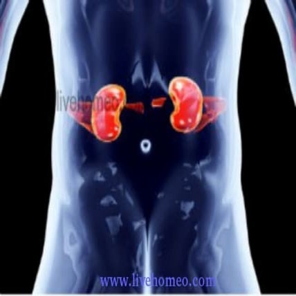 Disorders in kidney | PDF