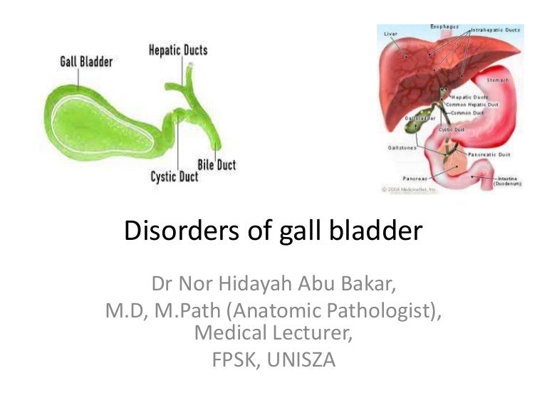Disorders of gall bladder