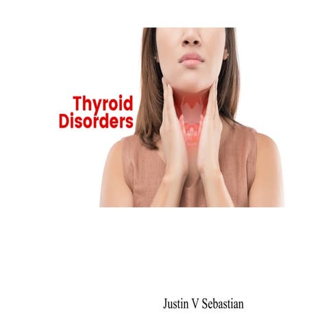Disorders of the thyroid gland