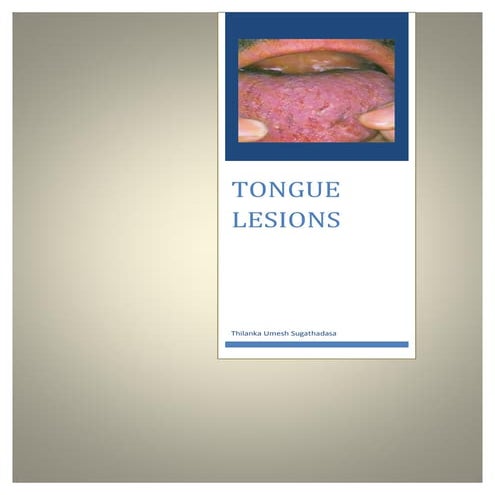 Disorders of the tongue