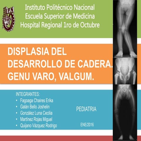Displasia del desarrollo de cadera, Genu Varo, Valgum