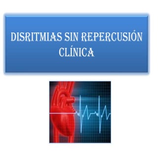Disritmias 2013