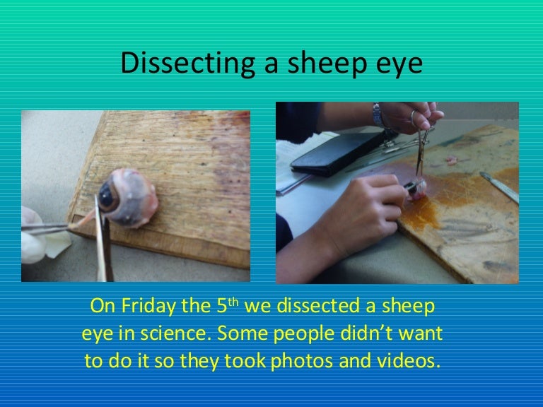 Dissecting A Sheep Eye