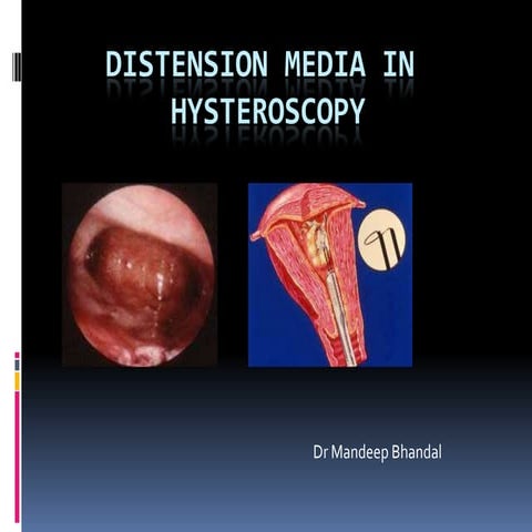 Distension media in hysteroscopy