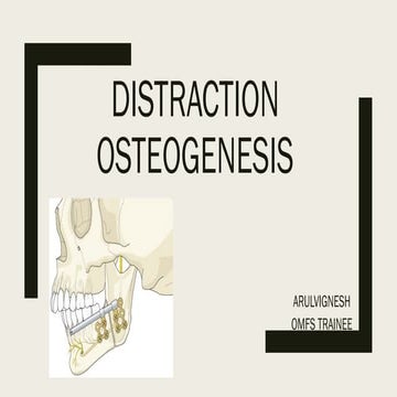 DISTRACTION OSTEOGENESIS OJ JAW OMFS.ppt