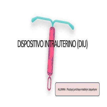 Insercción de un DIU | PPT