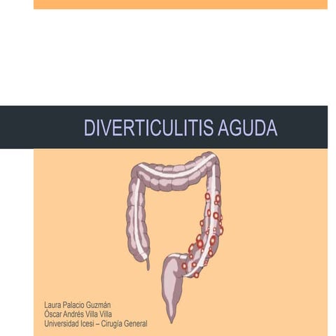 Diverticulitis Aguda