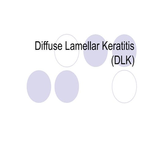 Dlk, Diffuse Lamellar Keratitis after lasik