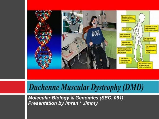 DUCHENNE MUSCULAR DYSTROPHY | PPTX