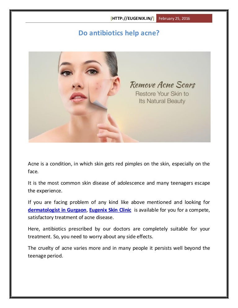 Antibiotics for Acne treatment