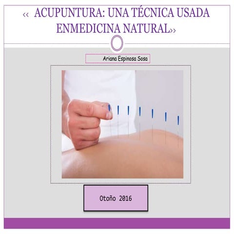 ACUPUNTURA: UNA TÉCNICA USADA EN MEDICINA NATURAL