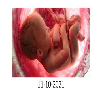 DOC-20220623-WA0005..pptx