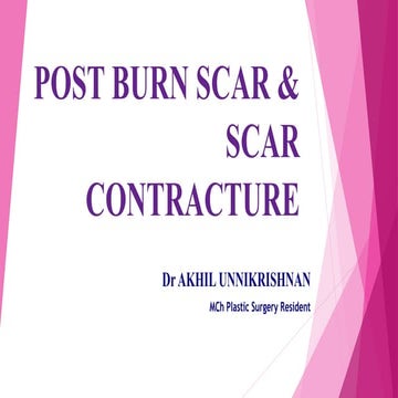 Post burn scar   and   scar contracture.