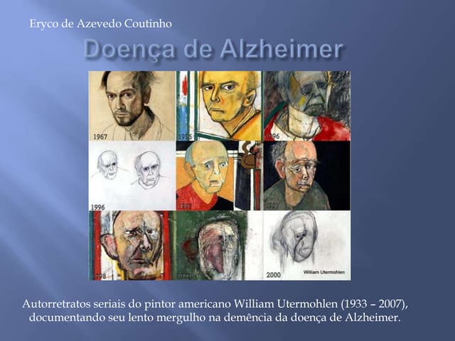 Doença de Alzheimer