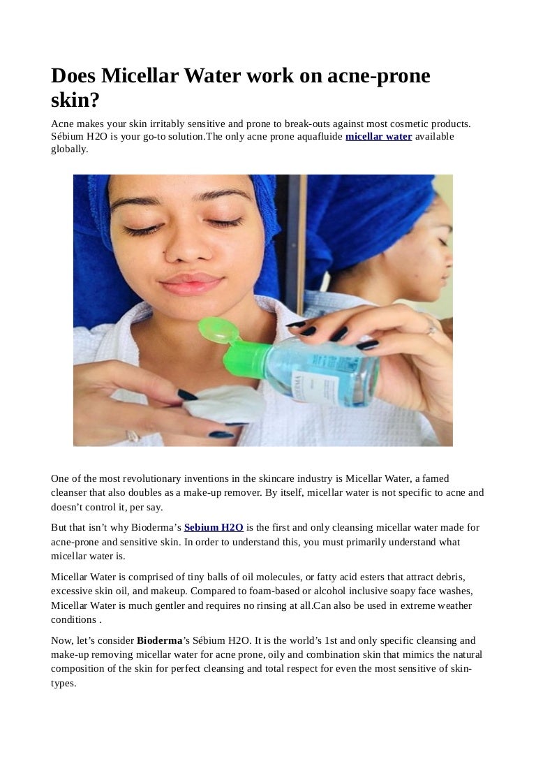 bioderma micellar water for acne